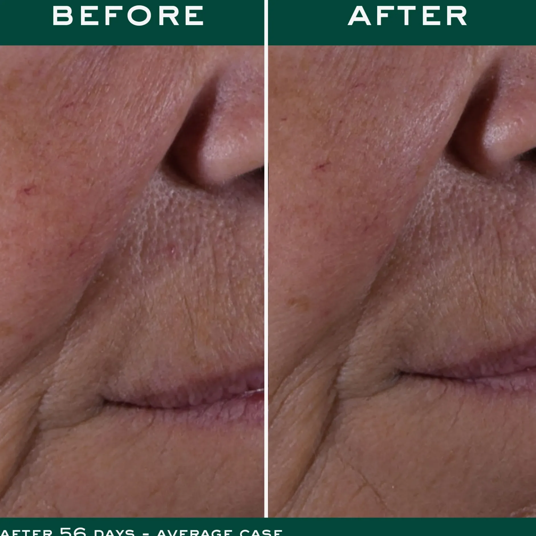 Fashion NUXE La Crema anti-età globale